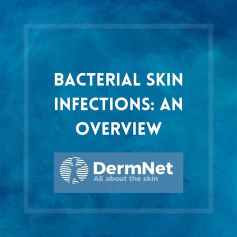 dermnet  linkedin  updated   dermnet page  bacterial