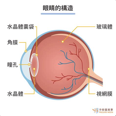 視網膜剝離症狀有哪些？前兆、症狀、自我檢查、原因、治療一次看