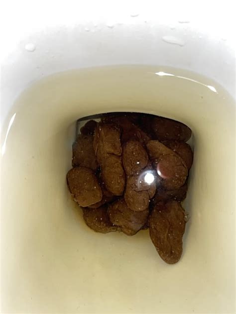 Is this blood in poop? It has multiple shades but can’t tell if it’s ...