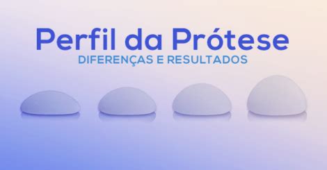 Meus Lindos e Pagos Arquivos Perfil da Prótese de Silicone