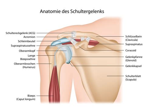 Schleimbeutelentz Ndung Der Schulter Bursitis Subacromialis