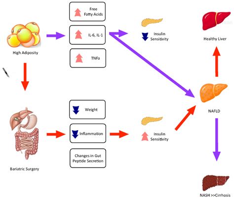 Jcm Free Full Text The Impact Of Bariatric Surgery Induced Weight