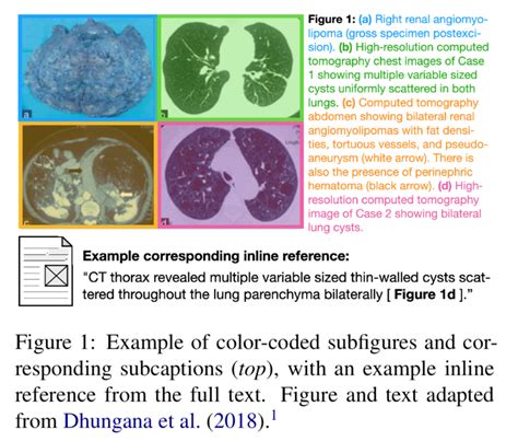 【医学图像描述】medicat 医学图像，描述和文字参考的数据集（emnlp Findings 2020） Ai导航