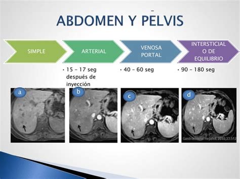 Medio De Contraste Gadolinio Ppt