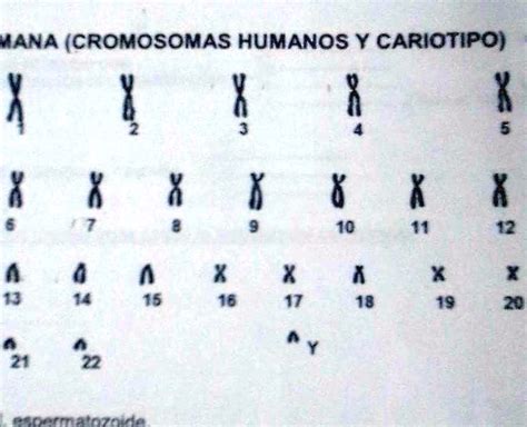 SOLVED en el dibujo que se observa pertenece a una célula humana