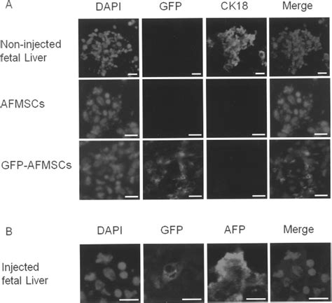 Immunofluorescence For Ck And Afp Expression In Fetal Liver And