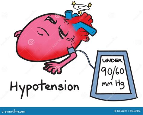 Hypotension Low Blood Pressure Cartoon Illustration Stock Image