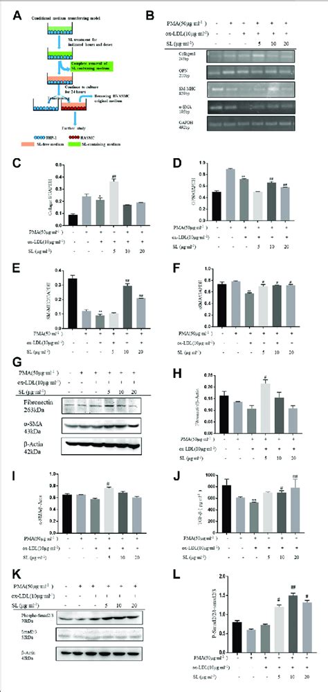 SL Increases The SMC Contractile Phenotype In The Macrophage SMC