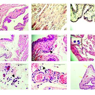 Cross Sections Histological Evaluation Hematoxylin And Eosin