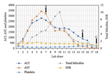 Medical Chart Ast And Alt Liver Range