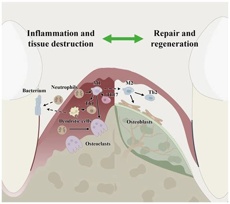 Ijms Free Full Text Regulation Of The Host Immune Microenvironment In Periodontitis And