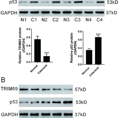 Trim69 And P53 Involved In Cataract Formation A Western Blot Results Download Scientific