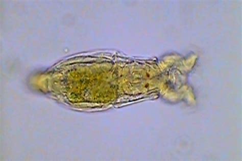 Key To Genera Of Bdelloid Rotifers