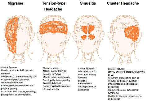 Paroxysmal Hemicrania Cluster Migraine