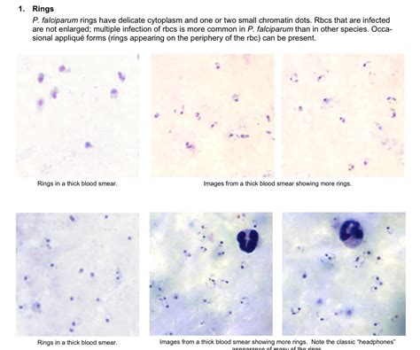 The Life Cycle Of Plasmodium Falciparum Plasmodium Falciparum