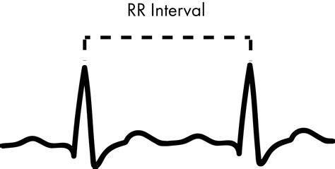 Ecg Analysis