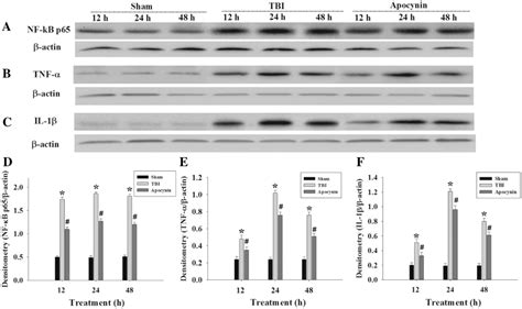 A Western Blot Analysis Demonstrates Levels Of Nf κb P65 Tnf α And