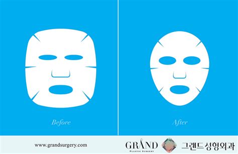 10 Plastic Surgery Ads From Around The World Zwivel Newsroom