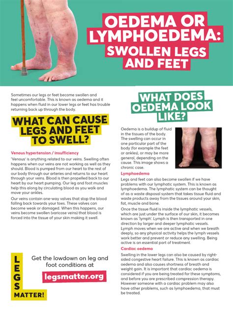 Legs Matter Patients Swollen Legs Feet A4 | PDF | Edema | Vein