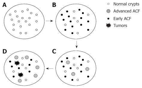 Azoxymethane Induced Rat Aberrant Crypt Foci Relevance In Studying