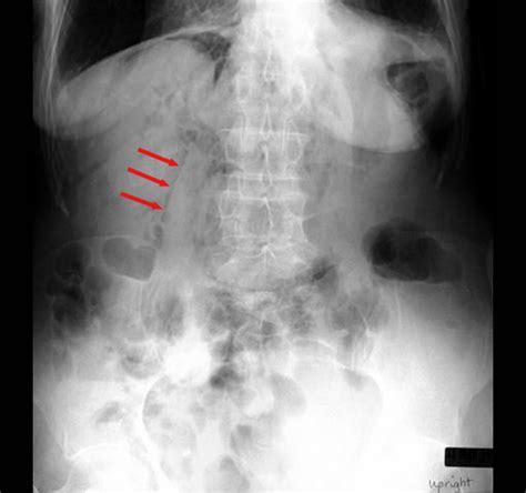 Gastrointestinal Radiology