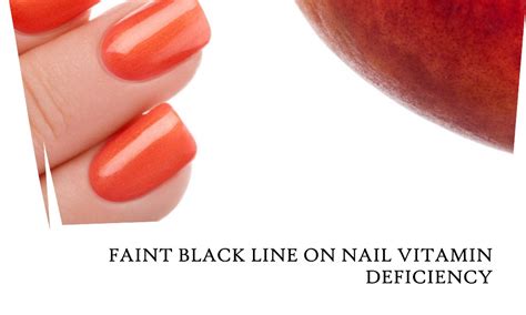 Faint Black Line On Nail And Vitamin Deficiency I Love Herbalism