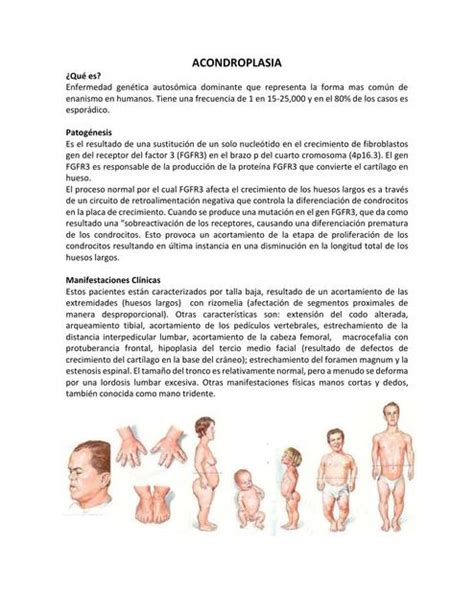 Acondroplasia Doctor Citos UDocz