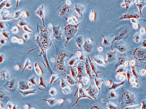 Immunofluorescence Confocal Imaging Of A Melanoma Cancer Cell Line