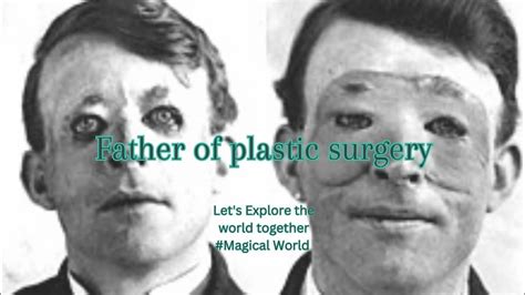 Father Of Plastic Surgery In World YouTube