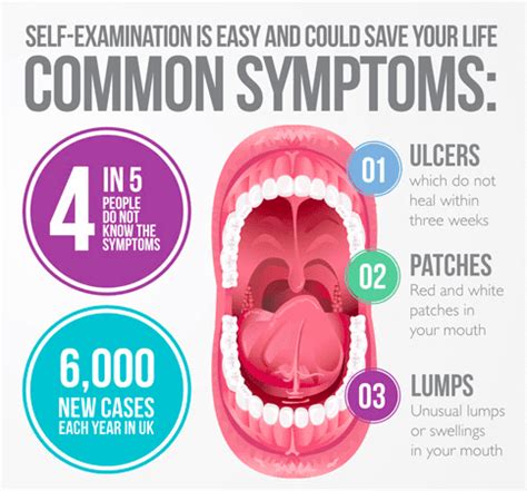 Oral Cancer Pictures Early Stages