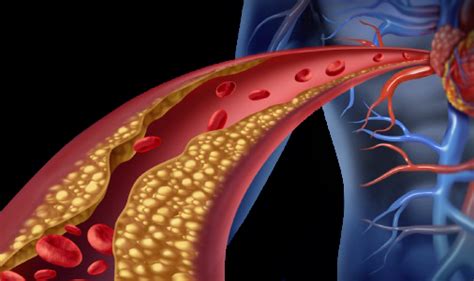 Vascular Smooth Muscle Cells and Cardiovascular Health