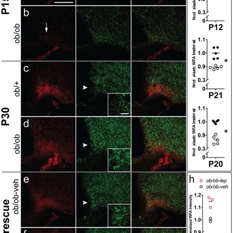 Wisteria Floribunda Agglutinin WFA Labeling In The Ventromedial ARC