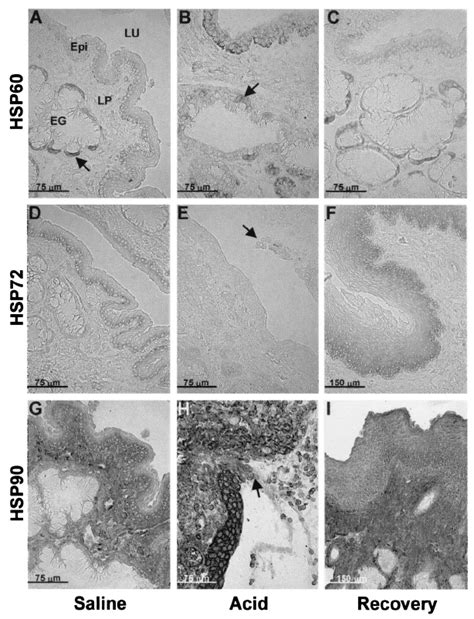 Immunohistochemical Localization Of Hsp60 A C Hsp72 D F And