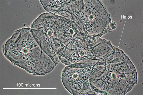 Phase Contrast Microscopy By Motic And Motic Microscopes