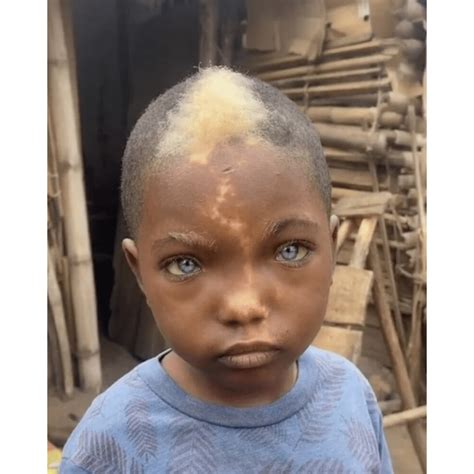 AH El niño africano es famoso por su raro cabello blanco sus ojos