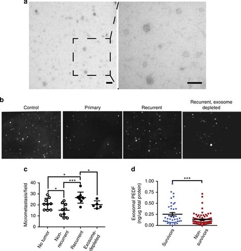 Northwestern Researchers Explore The Role Of Exosomes In Cancer