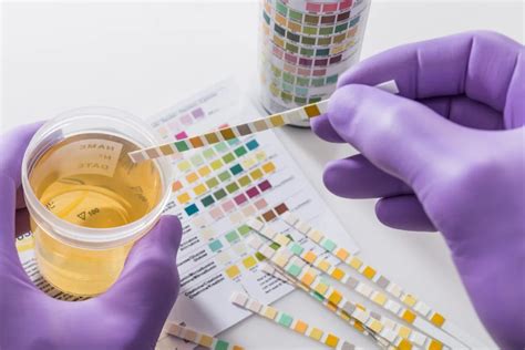 Prostate Cancer Noninvasive Urine Test Moves A Step Closer