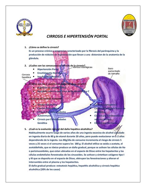 Cirrosis E Hipertension Portal CIRROSIS E HIPERTENSIÓN PORTAL Cómo