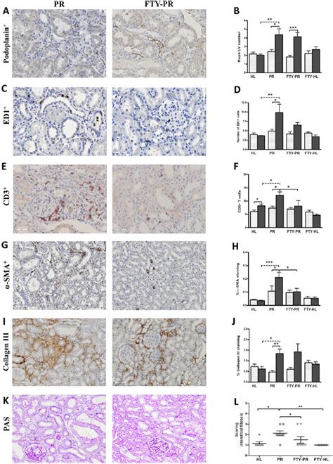 Effects Of FTY720 Treatment On Renal Lymphangiogenesis Inflammation