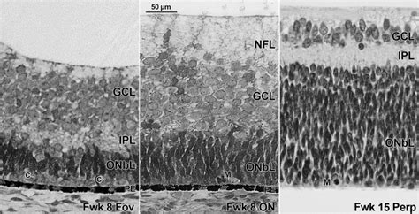 Development Of Retinal Layers In Prenatal Human Retina American