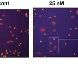 The Single Cell Gel Electrophoresis Comet Assay Of The Control And