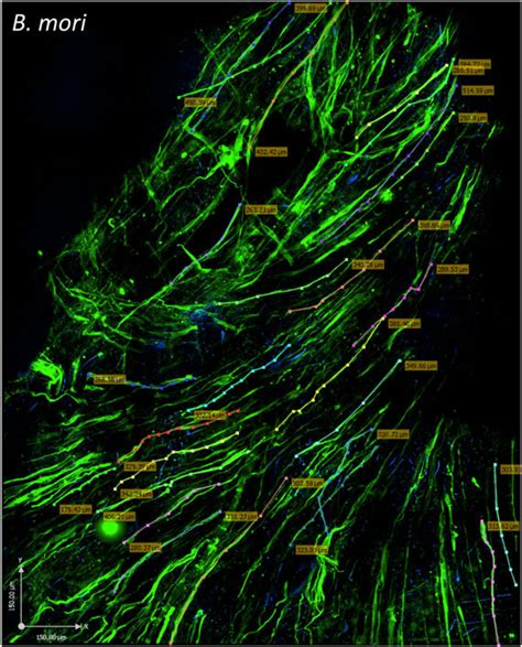 Human Skeletal Muscle Myoblasts HSMMs Form A Three Dimensional 3D