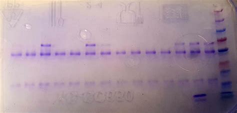 Sds Page Band Identification Purified Human Igg Yields Multiple Bands