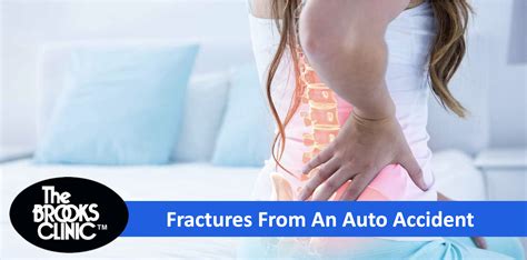 Fractures From Auto Accidents Accident Care At The Brooks Clinic