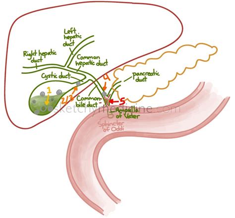 Gallbladder Disease Cholelithiasis Biliary Colic Cholecystitis