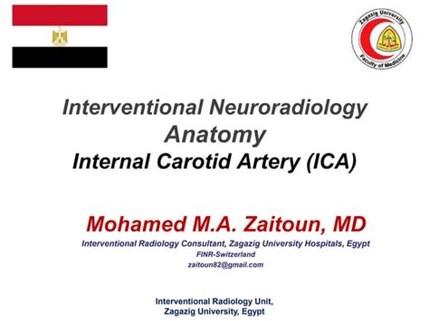 Interventional Neuroradiology: Anatomy of the internal carotid artery (ICA) | PPT