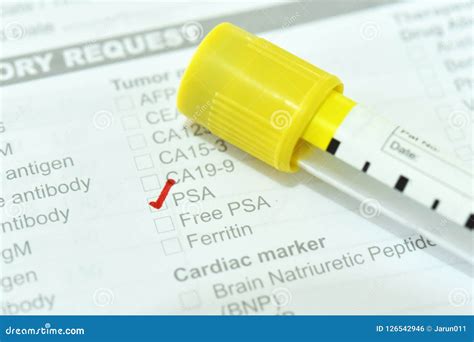 Blood Sample Tube For PSA Test Stock Photo Image Of Antigen