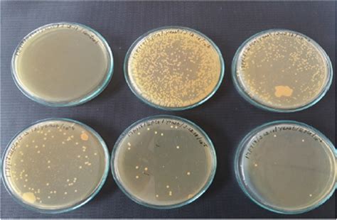 Isolation Of Yeast Stains From Yeast Extract Peptone Dextrose Agar