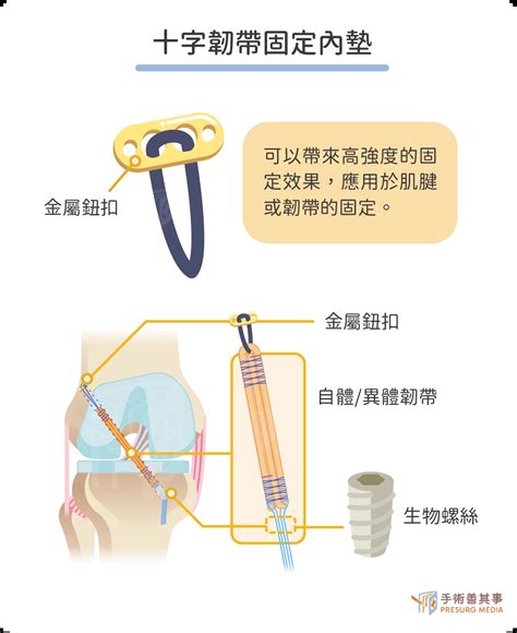 傷口小、術後恢復快 微創關節鏡手術正夯