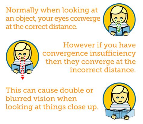 Convergence Insufficiency